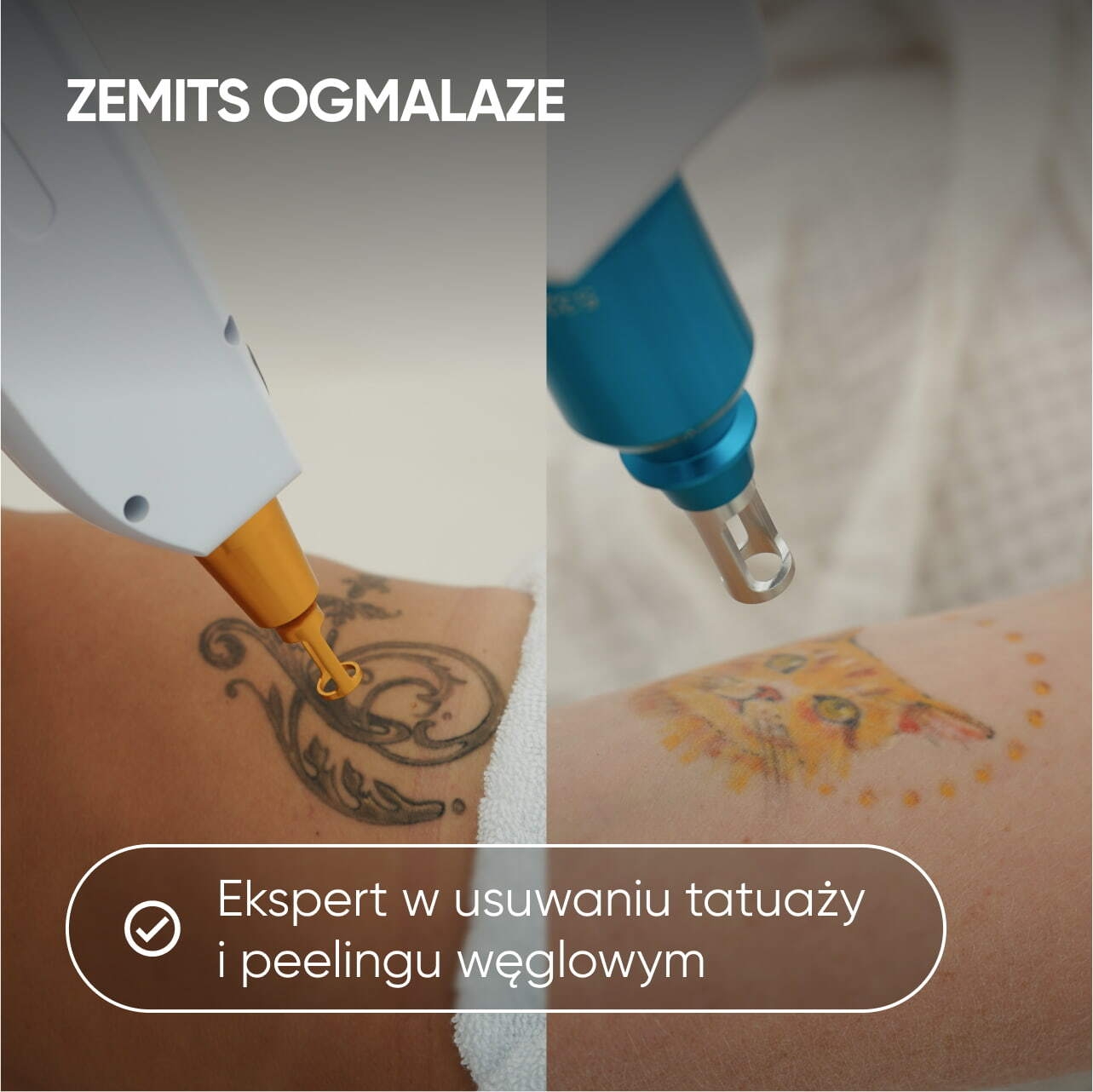 DLACZEGO ZEMITS OGMALAZE?