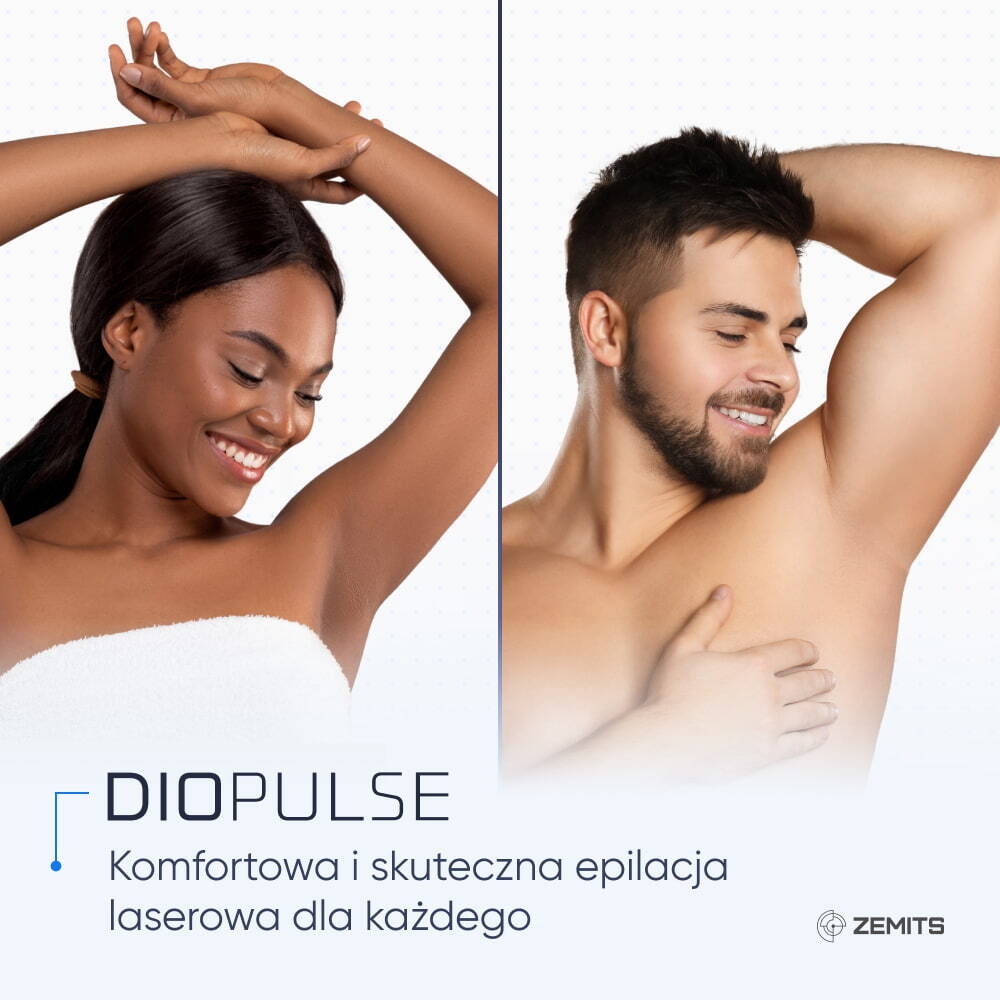KORZYŚCI Z DIOPULSE DLA TWOJEGO BIZNESU