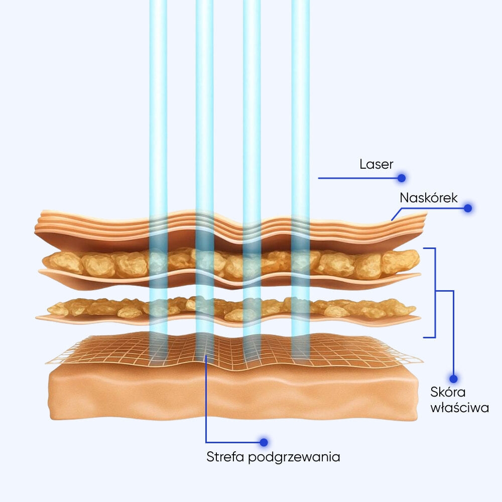 Technologia Zemits CarbonFrax Pro CO₂ NG