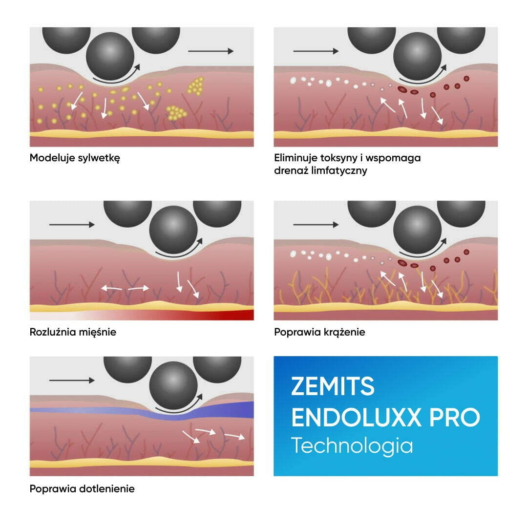 Technologia Endoluxx Pro